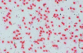 Как выглядят лейкоциты под микроскопом